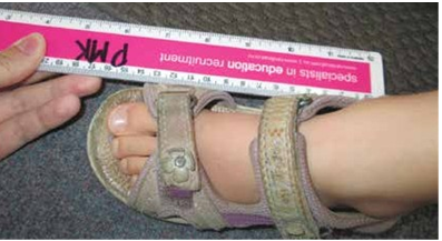 Learning to measure feet